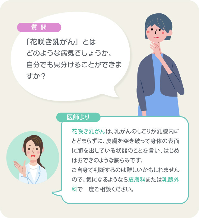 花咲き乳がん とは 皮膚科的なできものとの違いについて 女性のための健やか便り Aic八重洲クリニック 乳腺外科 東京